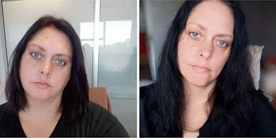 Before and after pictures, weight loss